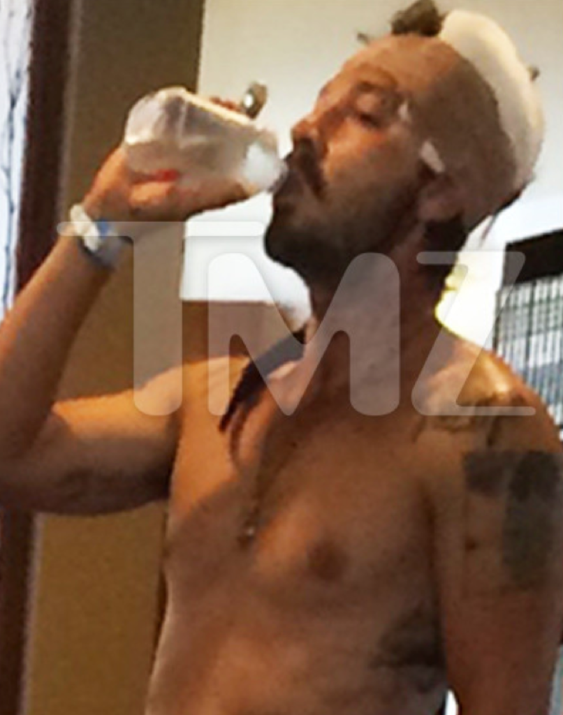 Hollywood - kinh đô điện ảnh hoa lệ cũng đầy rẫy tai nạn gây trọng thương và chết người! - Ảnh 4. Hollywood - kinh đô điện ảnh hoa lệ cũng đầy rẫy tai nạn gây trọng thương và chết người! - Ảnh 4.