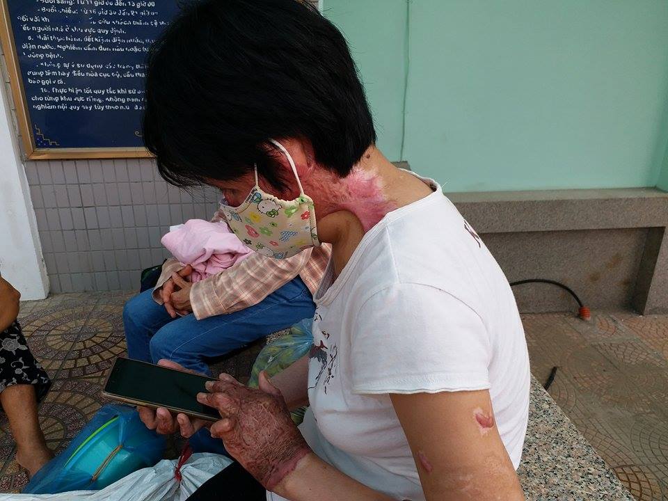 Gặp lại người phụ nữ từng bị chồng nhốt, tẩm xăng thiêu sống: Tôi không còn oán hận, chỉ mong có ngày đoàn tụ với con - Ảnh 5. Gặp lại người phụ nữ từng bị chồng nhốt, tẩm xăng thiêu sống: Tôi không còn oán hận, chỉ mong có ngày đoàn tụ với con - Ảnh 5.