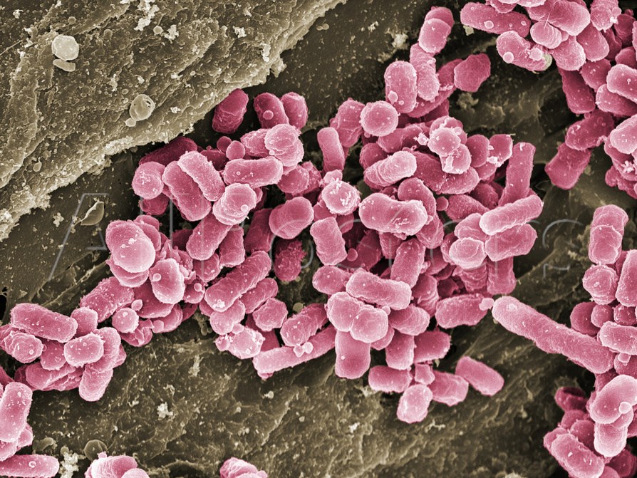 Bạn cho rằng thớt nhựa sạch hơn thớt gỗ? Bạn sẽ nghĩ lại ngay sau khi đọc bài viết này - Ảnh 3. Bạn cho rằng thớt nhựa sạch hơn thớt gỗ? Bạn sẽ nghĩ lại ngay sau khi đọc bài viết này - Ảnh 3.