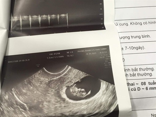 Vụ người vợ 28 tuổi hút mỡ bụng xong mới biết có thai: Bác sĩ thực hiện phẫu thuật sử dụng chứng chỉ giả - Ảnh 1.