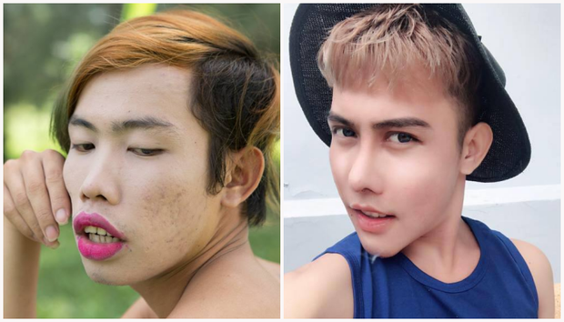 Không thể nhận ra Tùng Sơn sau khi phẫu thuật đại tu nhan sắc! - Ảnh 2.