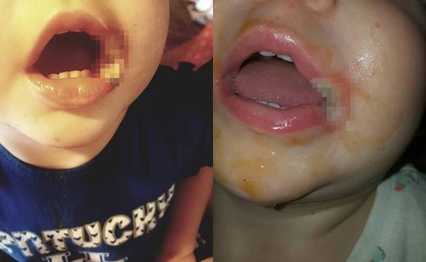 Để con nhỏ 19 tháng tuổi nghịch sạc điện thoại, khi người mẹ phát hiện ra thì đã quá muộn - Ảnh 1. Để con nhỏ 19 tháng tuổi nghịch sạc điện thoại, khi người mẹ phát hiện ra thì đã quá muộn - Ảnh 1.