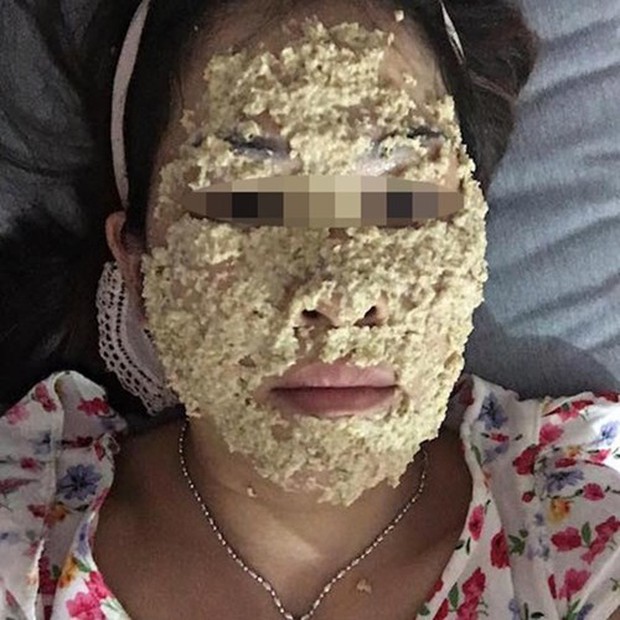 Những hình ảnh không thể chân thực hơn cho thấy, trước khi xinh, chị em phải vật vã như thế nào - Ảnh 7. Những hình ảnh không thể chân thực hơn cho thấy, trước khi xinh, chị em phải vật vã như thế nào - Ảnh 7.