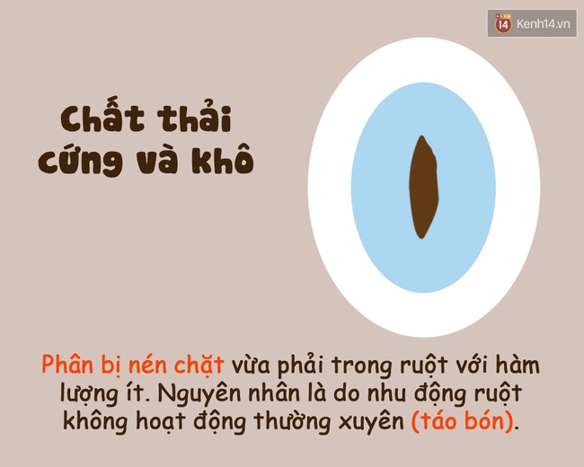 Xem hình dáng chất thải tế nhị biết ngay cơ thể bạn đang như thế nào! - Ảnh 7.