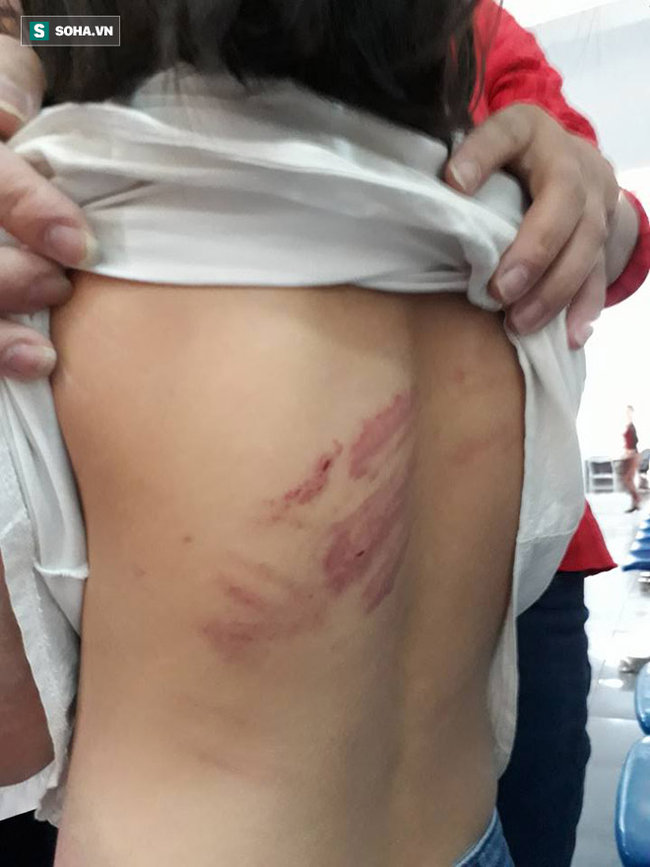 Bố say rượu liên tục đánh, đạp vào bụng con gái 9 tuổi ở Vĩnh Phúc - Ảnh 2. Bố say rượu liên tục đánh, đạp vào bụng con gái 9 tuổi ở Vĩnh Phúc - Ảnh 2.
