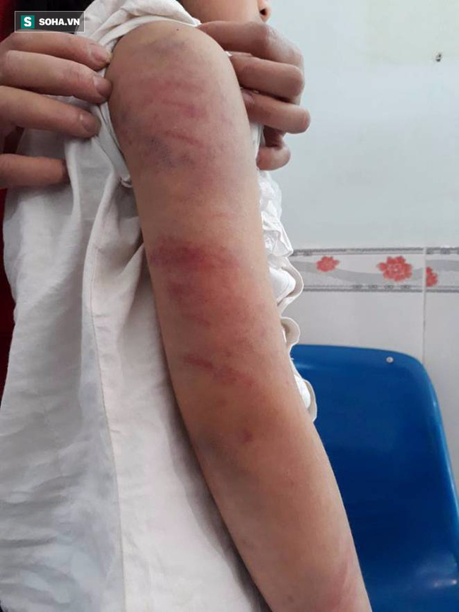 Bố say rượu liên tục đánh, đạp vào bụng con gái 9 tuổi ở Vĩnh Phúc - Ảnh 3. Bố say rượu liên tục đánh, đạp vào bụng con gái 9 tuổi ở Vĩnh Phúc - Ảnh 3.