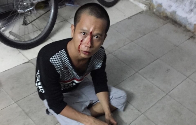 (HY HỮU) Tên cướp bị CSGT bắt vì... kẹt xe! - Ảnh 1. (HY HỮU) Tên cướp bị CSGT bắt vì... kẹt xe! - Ảnh 1.