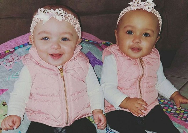 Kỳ lạ hai bé gái sinh đôi nhưng có hai màu da hoàn toàn trái ngược - Ảnh 1.