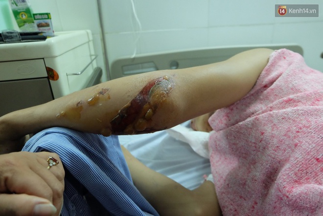 Người thân không nhận ra nam sinh mắc kẹt dưới gầm ô tô Camry sau tai nạn kinh hoàng ở Bắc Ninh - Ảnh 3.