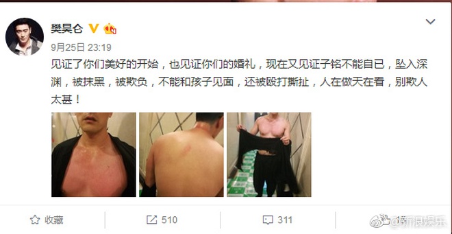 Hậu ly hôn, bạn gái một thời của Thích Tiểu Long hành hung chồng cũ tàn bạo? - Ảnh 2. Hậu ly hôn, bạn gái một thời của Thích Tiểu Long hành hung chồng cũ tàn bạo? - Ảnh 2.