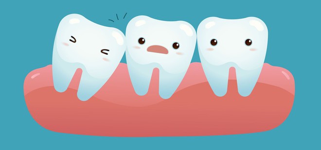 Đây là những cách để giảm sự hoành hành của chiếc răng ngu - Ảnh 4.