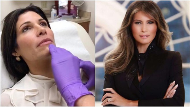 Sau Ivanka Trump, đến lượt Đệ nhất phu nhân Mỹ Melania trở thành miếng mồi béo bở cho các thẩm mỹ viện - Ảnh 1.