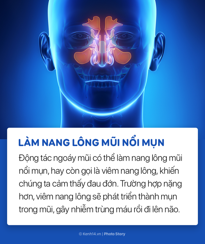 Hãy cẩn thận với thói quen ngoáy mũi tưởng chừng như vô hại của bạn! - Ảnh 5.