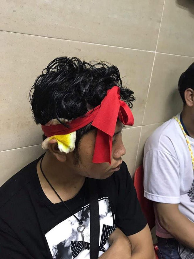 Không được hưởng niềm vui chiến thắng, CĐV Myanmar còn bị fan Malaysia đánh chảy máu đầu - Ảnh 8.