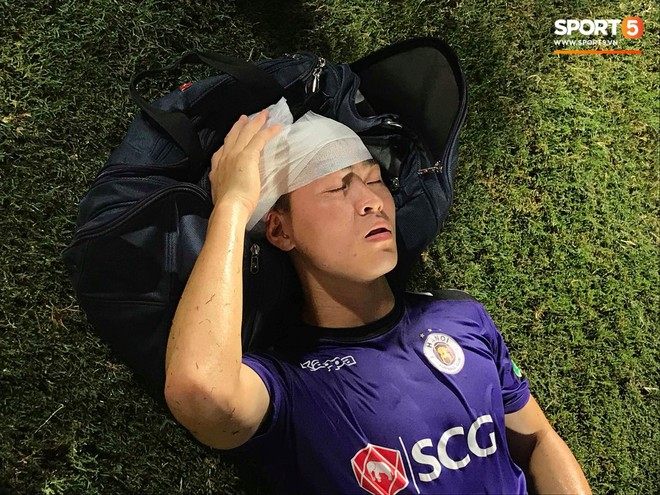 Duy Mạnh nằm sân sau trận đấu, nhập viện gấp để kiểm tra chấn thương - Ảnh 4.