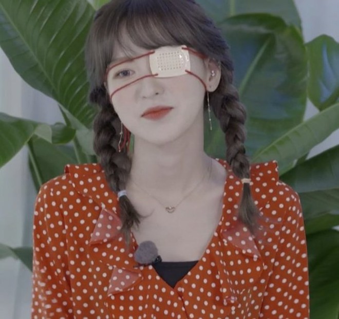 Fan lo lắng khi Wendy (Red Velvet) gặp tai nạn sân khấu đến nỗi phải băng một mắt ngay thời điểm nhóm vừa trở lại - Ảnh 1. Fan lo lắng khi Wendy (Red Velvet) gặp tai nạn sân khấu đến nỗi phải băng một mắt ngay thời điểm nhóm vừa trở lại - Ảnh 1.