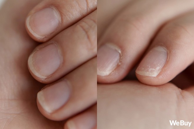 Thanh niên mua mút rửa bát thần kỳ quảng cáo trên mạng, ngờ đâu rửa xong bát đũa đi luôn bộ móng tay - Ảnh 8. Thanh niên mua mút rửa bát thần kỳ quảng cáo trên mạng, ngờ đâu rửa xong bát đũa đi luôn bộ móng tay - Ảnh 8.