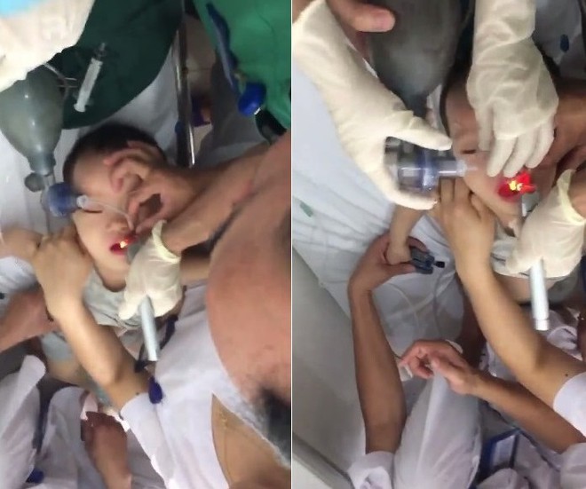 Hơn 15 phút “căng não” cấp cứu bé trai 2 tuổi ngưng thở khi bị hóc thạch rau câu - Ảnh 2.