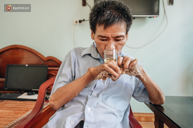 Số phận cay đắng của người cây kì lạ nhất Việt Nam: Mẹ cõng con đi điều trị gần 50 năm, phải uống thuốc ngủ để quên cơn đau - Ảnh 5.