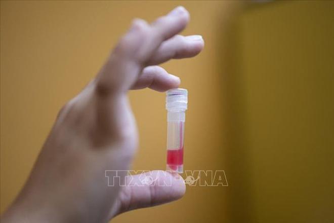 Diễn biến dịch COVID-19 ngày 21/4: Đại dịch khiến hàng triệu trẻ em Trung Đông rơi vào cảnh nghèo đói, hơn 143.000 ca nhiễm tại Đức - Ảnh 1.