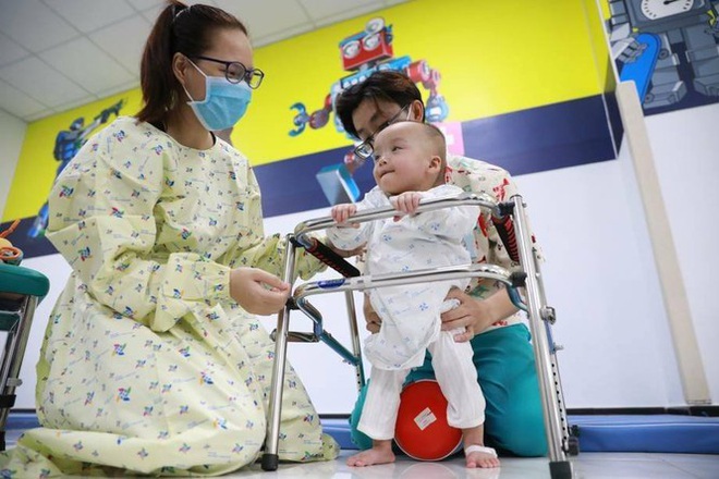 Trúc Nhi - Diệu Nhi hồn nhiên chơi đồ hàng sau 2 tháng phẫu thuật tách dính, nụ cười rạng rỡ và đáng yêu - Ảnh 3. Trúc Nhi - Diệu Nhi hồn nhiên chơi đồ hàng sau 2 tháng phẫu thuật tách dính, nụ cười rạng rỡ và đáng yêu - Ảnh 3.