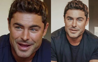 Zac Efron (High School Musical) náo loạn cả Twitter vì gương mặt gây sốc, thảm họa "dao kéo" mới là đây?