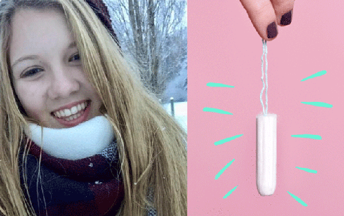 Thêm một trường hợp sốc độc tố vì dùng tampon sai cách khiến cô gái này phải qua đời khi mới 16 tuổi