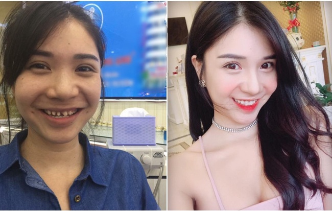 Thanh Bi lên tiếng về hình ảnh răng khấp khiểng, mặt mộc kém sắc trong quá khứ