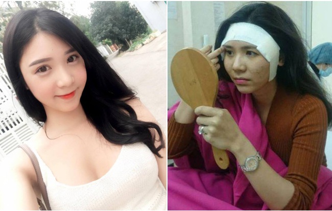 Khẳng định chỉ làm răng nhưng Thanh Bi lại lộ ảnh cận cảnh đang phẫu thuật thẩm mỹ?