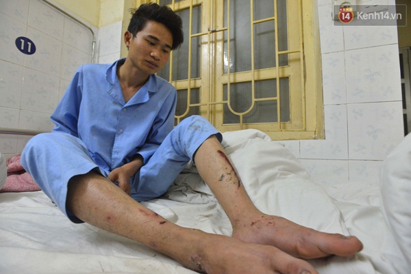 Lời kể kinh hoàng của những nạn nhân may mắn thoát chết trong vụ tai nạn ở đèo Thung Khe - Ảnh 5.