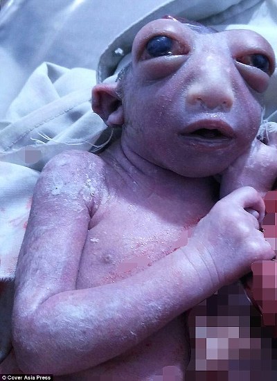 Em bé ngoài hành tinh sinh ra tại Ấn Độ - Ảnh 1.