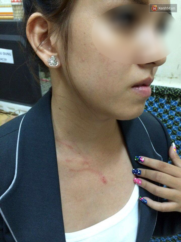 Sài Gòn sắp c&oacute; đội săn bắt cướp - Ảnh 2.