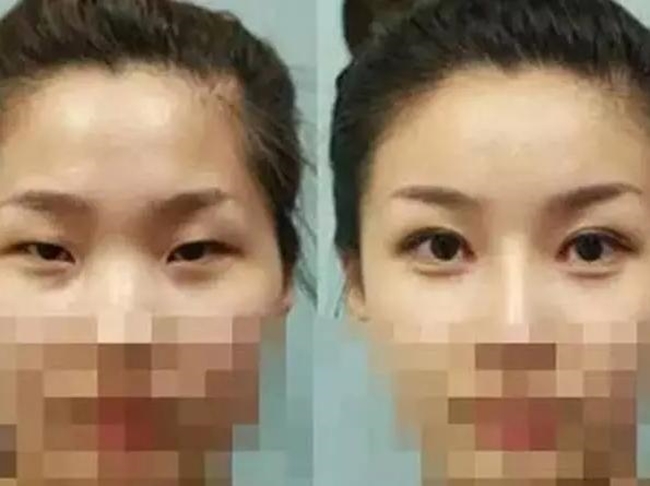 Sau nửa năm đi cắt m&iacute; mắt, nữ sinh bỗng ph&aacute;t hiện bị nhiễm HIV - Ảnh 2.