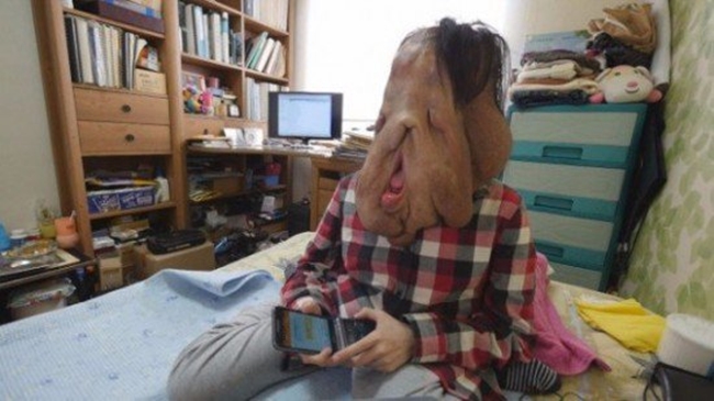 Cộng đồng mạng Hàn Quốc kêu gọi giúp đỡ người phụ nữ có gương mặt biến dạng vì mắc bệnh lạ - Ảnh 1.