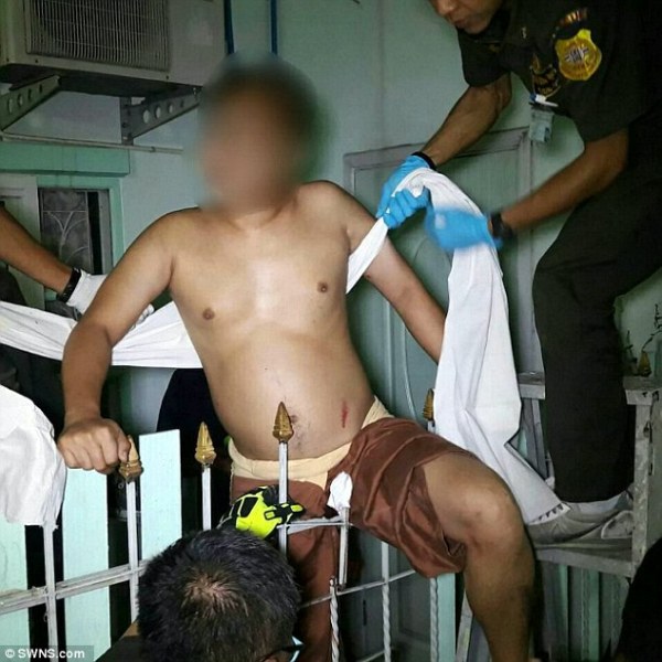 Trèo lên lan can phơi quần áo, một thanh niên bị hàng rào sắt đâm trúng chỗ hiểm - Ảnh 1.