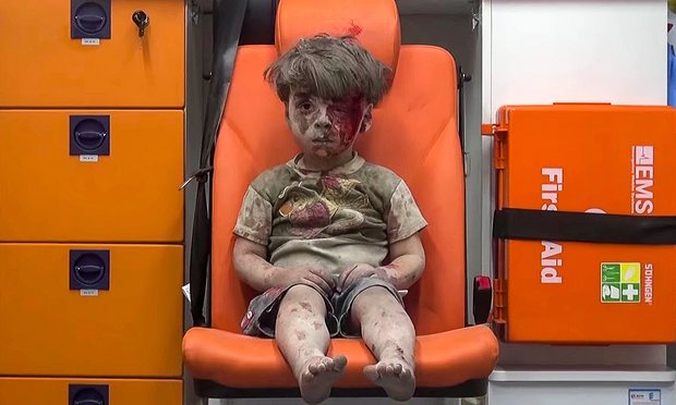 Nhiếp ảnh gia kể lại khoảnh khắc đau đớn khi chụp bức ảnh cậu bé Syria bị thương - Ảnh 1.