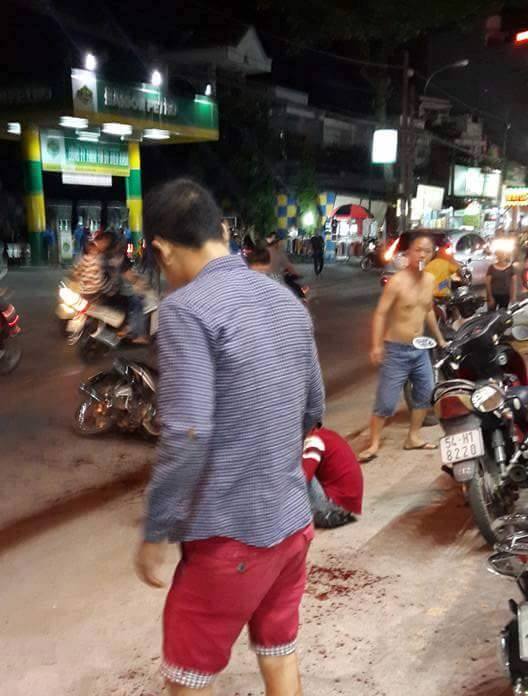 Đang phẫu thuật gh&eacute;p lại b&agrave;n tay cho thanh ni&ecirc;n 17 tuổi bị truy s&aacute;t ở G&ograve; Vấp - Ảnh 3.