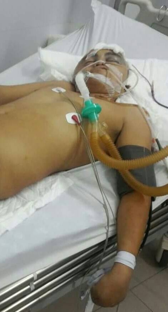 C&ocirc; g&aacute;i 19 tuổi k&ecirc;u gọi gi&uacute;p đỡ nam sinh bị chấn thương sọ n&atilde;o sau tai nạn giao th&ocirc;ng - Ảnh 2.