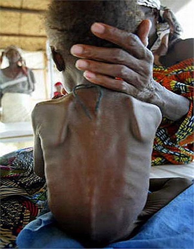 Chùm ảnh những đứa trẻ châu Phi gầy trơ xương vì đói sẽ khiến bạn không dám bỏ thừa đồ ăn thêm nữa - Ảnh 7.