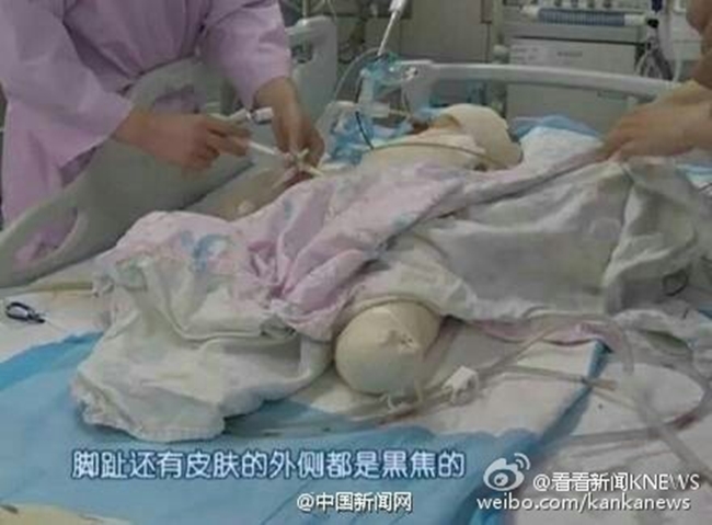 Bật máy sấy dỗ dành, người mẹ Trung Quốc vô tình hại con trai 6 tháng tuổi cháy sém - Ảnh 3.