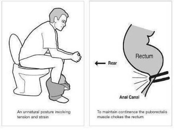 Đây chính là cách để bạn đi cầu sao cho sạch nhất - Ảnh 5.