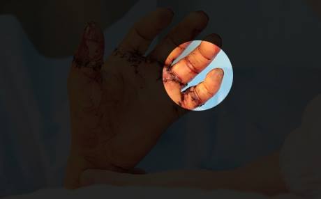Sai lầm khi bảo quản c&oacute; thể khiến nam thanh ni&ecirc;n tự chặt tay mất tay vĩnh viễn - Ảnh 2.