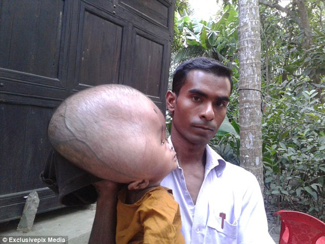 Nh&igrave;n b&eacute; trai đầu to nặng tới 9kg, bạn mới thấy m&igrave;nh c&ograve;n may mắn hơn bao người - Ảnh 3.