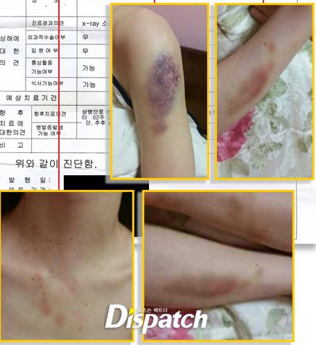 Ng&ocirc;i sao ch&acirc;u &Aacute; v&agrave; những lần bị b&oacute;c phốt v&igrave; n&oacute;i dối - Ảnh 6.
