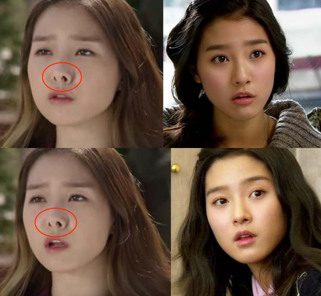 Nàng cháo Kim So Eun khiến fan phát hoảng: Lại là lỗ mũi dị dạng! - Ảnh 3.