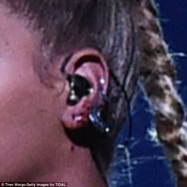 Tóc mắc vào khuyên làm tai chảy máu be bét, Beyoncé vẫn biểu diễn như không có chuyện gì - Ảnh 2.