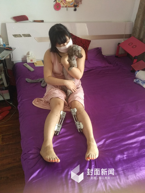 Hậu quả kinh hoàng của cô gái cuồng dao kéo nhất Trung Quốc với 200 lần phẫu thuật thẩm mỹ - Ảnh 3.