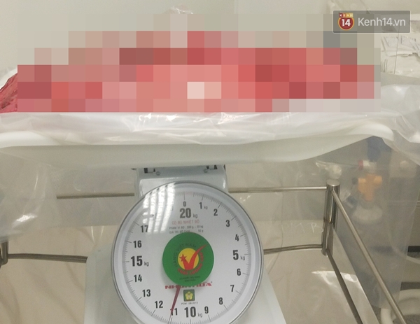 Phẫu thuật thành công khối u nặng 13kg trong bụng bà cụ 100 tuổi ở Đồng Nai - Ảnh 2.