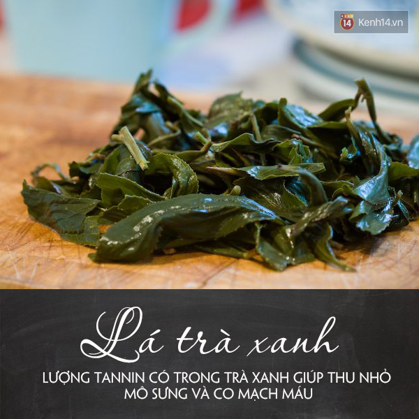 7 cách để loại bỏ nhanh những vết bầm trên cơ thể - Ảnh 2.