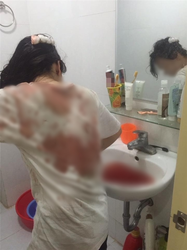 Hà Nội: Cô gái trẻ bị cướp giật túi xách, bất tỉnh trên đường Giải Phóng - Ảnh 3.
